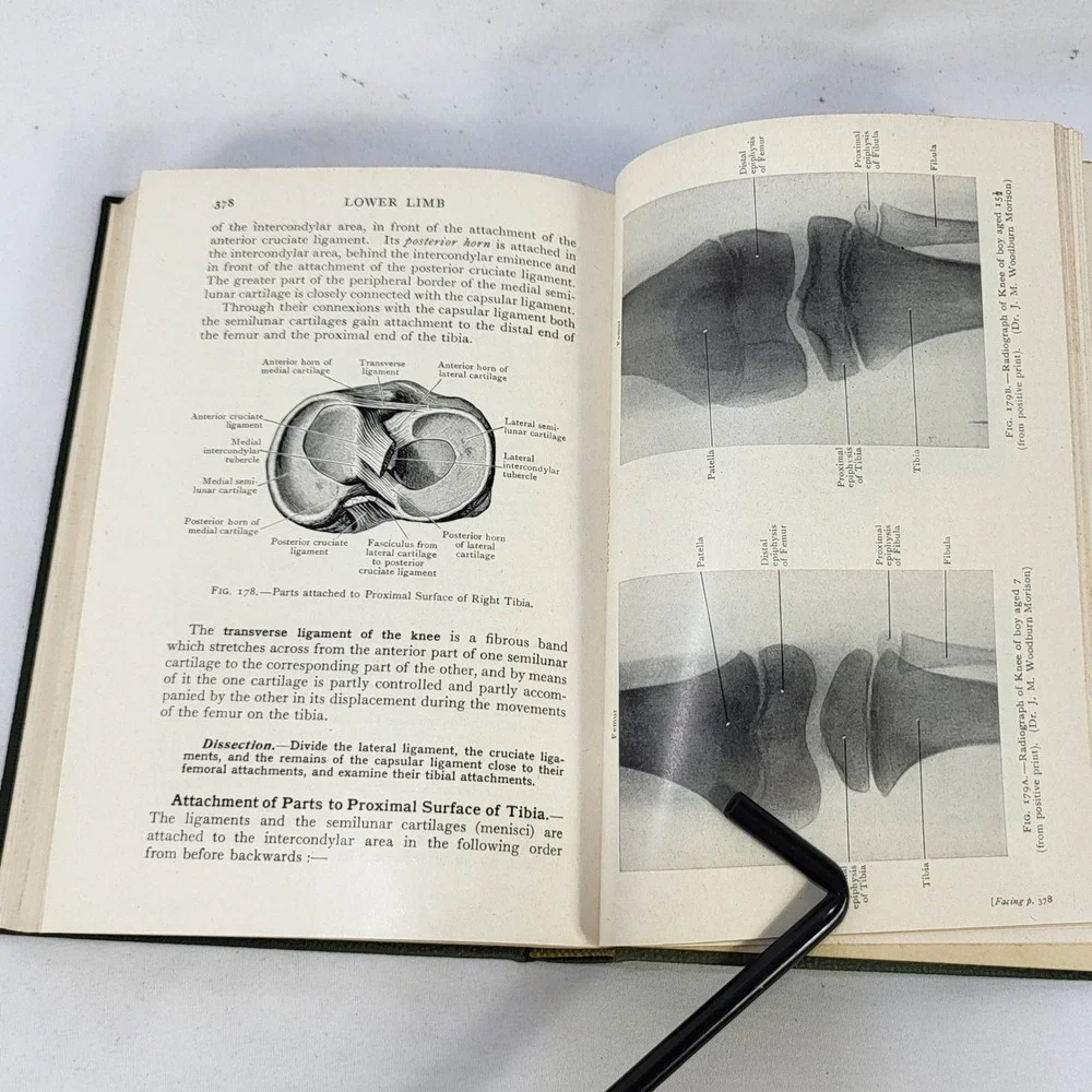 Cunningham's Manual of Practical Anatomy Vol 1 10th Ed 1940 Oxford Medical Book